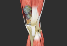 Knee Trauma Reconstruction