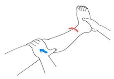 Nonoperative Treatments for ACL Injuries