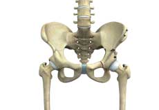 Periacetabular Osteotomy